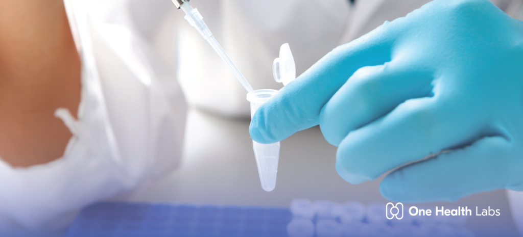 PCR vs. Antigen Test: Which COVID Test Do You Need? | One Health Labs